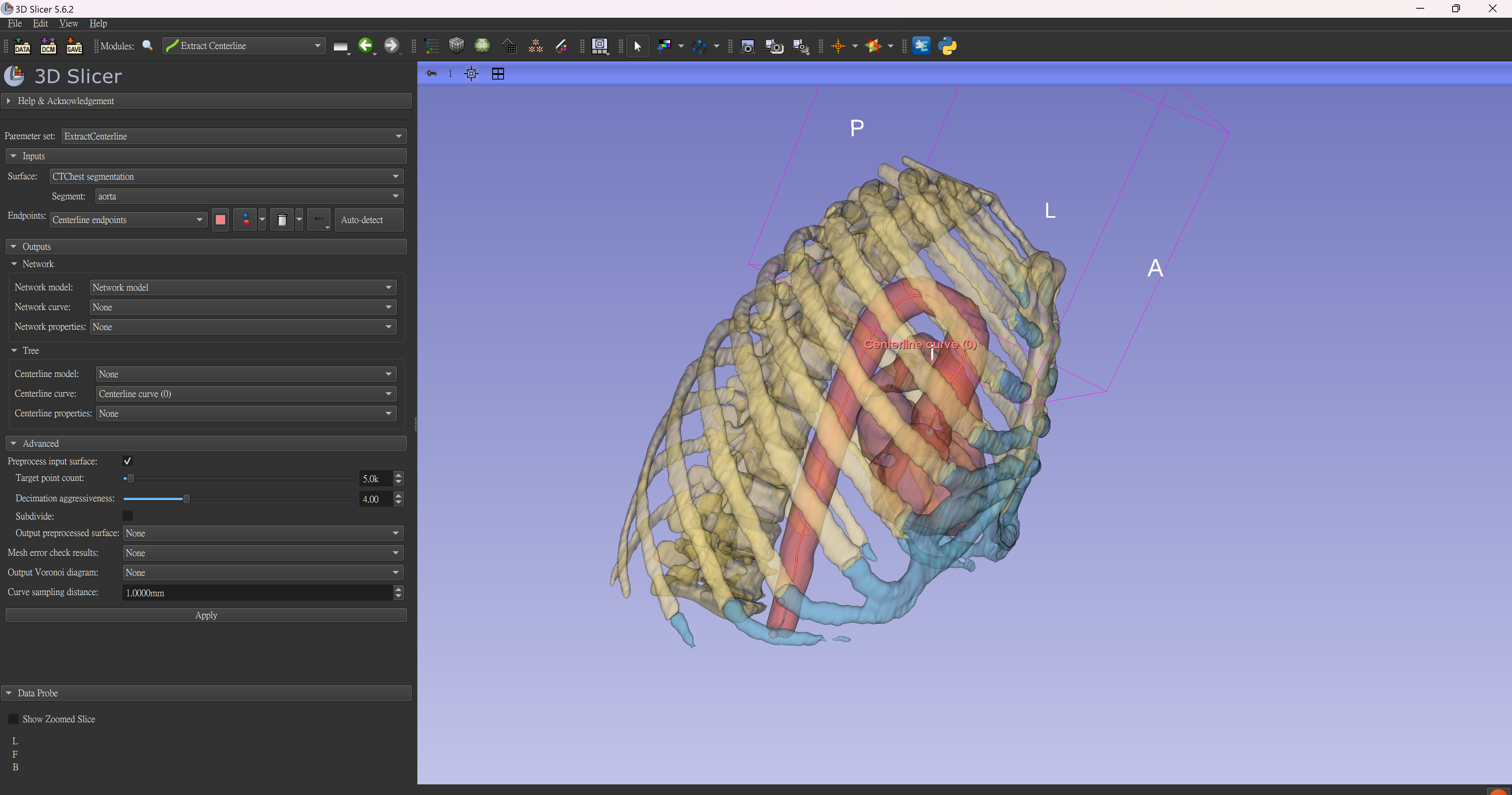 醫療CT影像3D可視化平台研究案 — 3